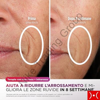 Shark Cryoglow Maschera per il viso led